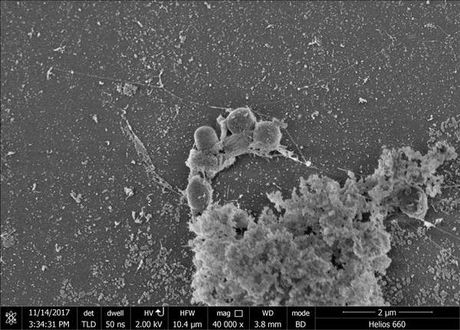 Plastic Eating Bacteria Plastic Eating Bacteria 1